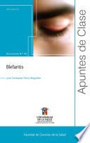 Blefaritis