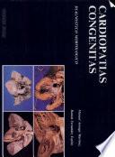 Cardiopatias congenitas