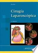 Cirugía laparoscópica
