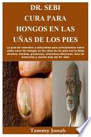 Dr. Sebi Cura para hongos en las uñas de los pies