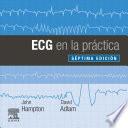 ECG En La Práctica