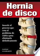 Hernia de disco - cerrar sin cirugía