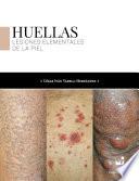 Huellas