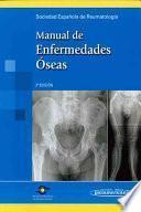 Manual De Enfermedades Oseas / Bone Diseases Manual