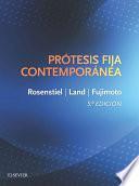 Prótesis fija contemporánea