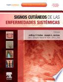 Signos cutáneos de las enfermedades sistémicas