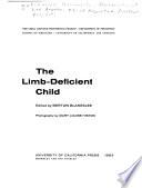 The limb-deficient child
