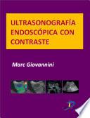 Ultrasonografía endoscópica con contraste
